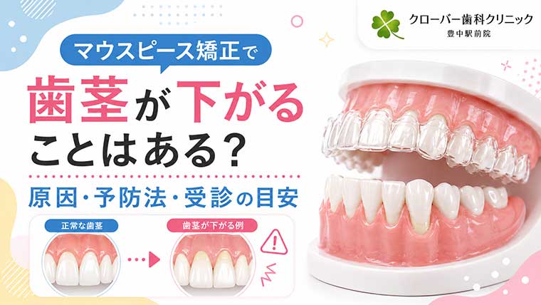 マウスピース矯正で歯茎が下がることはある？原因・予防法・受診の目安