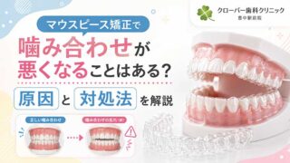 マウスピース矯正で噛み合わせが悪くなることはある？原因と対処法を解説