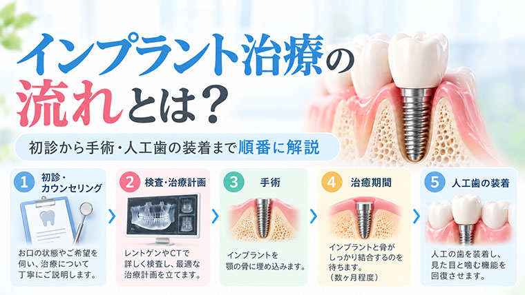 インプラント治療の流れとは？初診から手術・人工歯の装着まで順番に解説