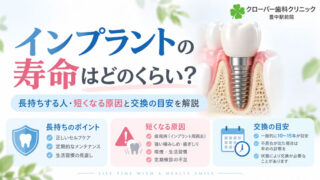 インプラントの寿命は何年？長持ちさせるポイントと交換の目安を解説