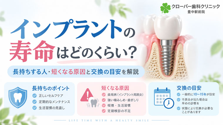 インプラントの寿命は何年？長持ちさせるポイントと交換の目安を解説