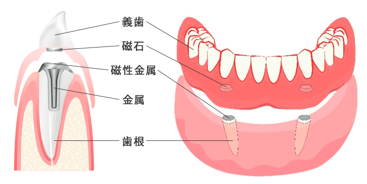 ΂̓ꎕ̍\