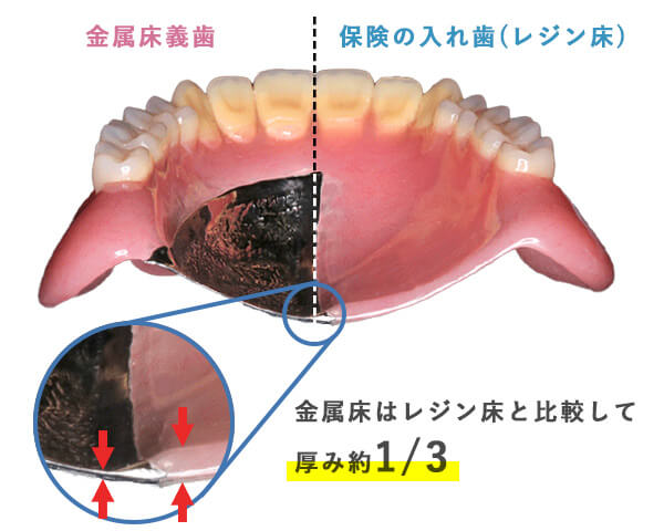 `ƕی̓ꎕ