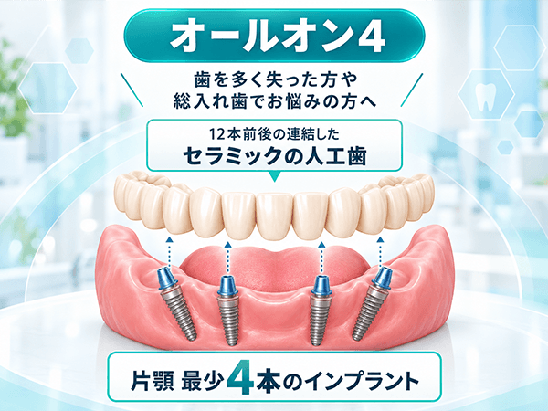 オールオン4